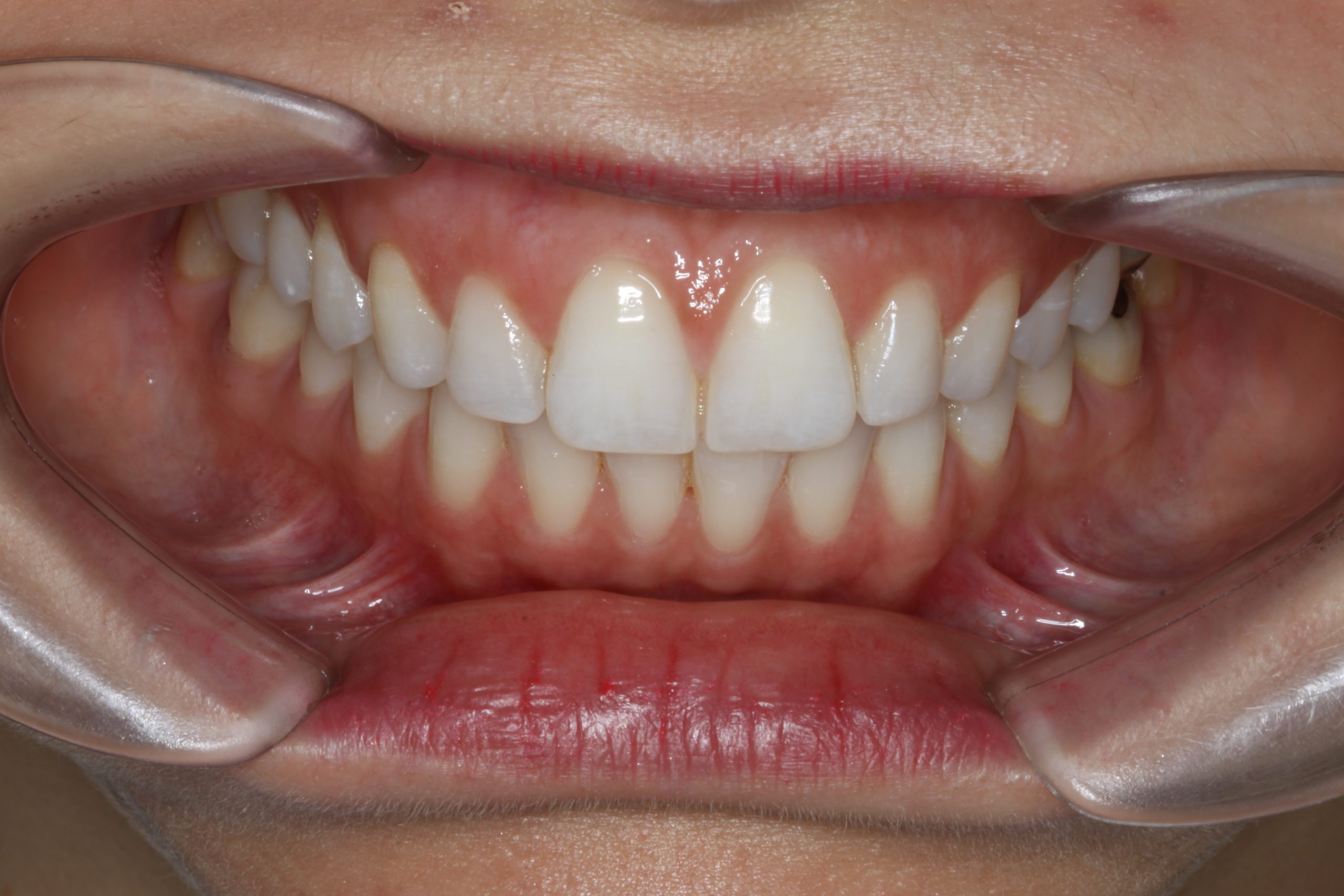 periodoncia- pias clinica dental